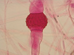 MISSING THUMBNAIL